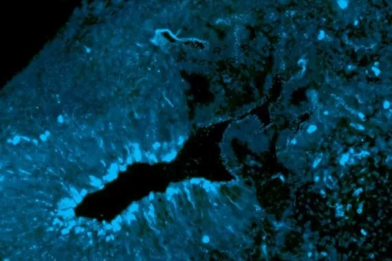 Makrokuva aivo-organoidista Makrokuva aivo-organoidista