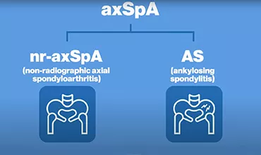 axspa video thumbnail